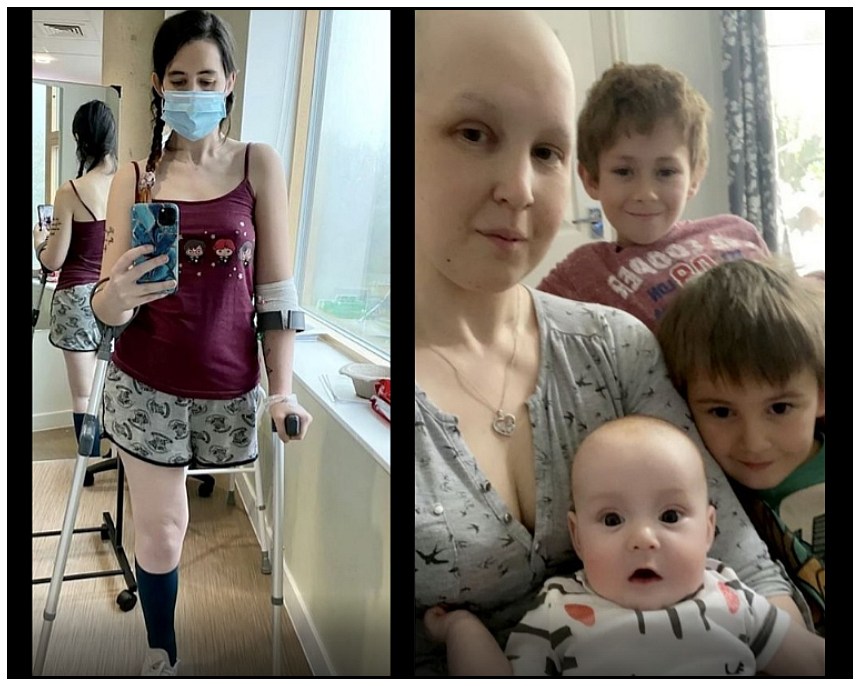 mom with cancer loses a leg to save her baby