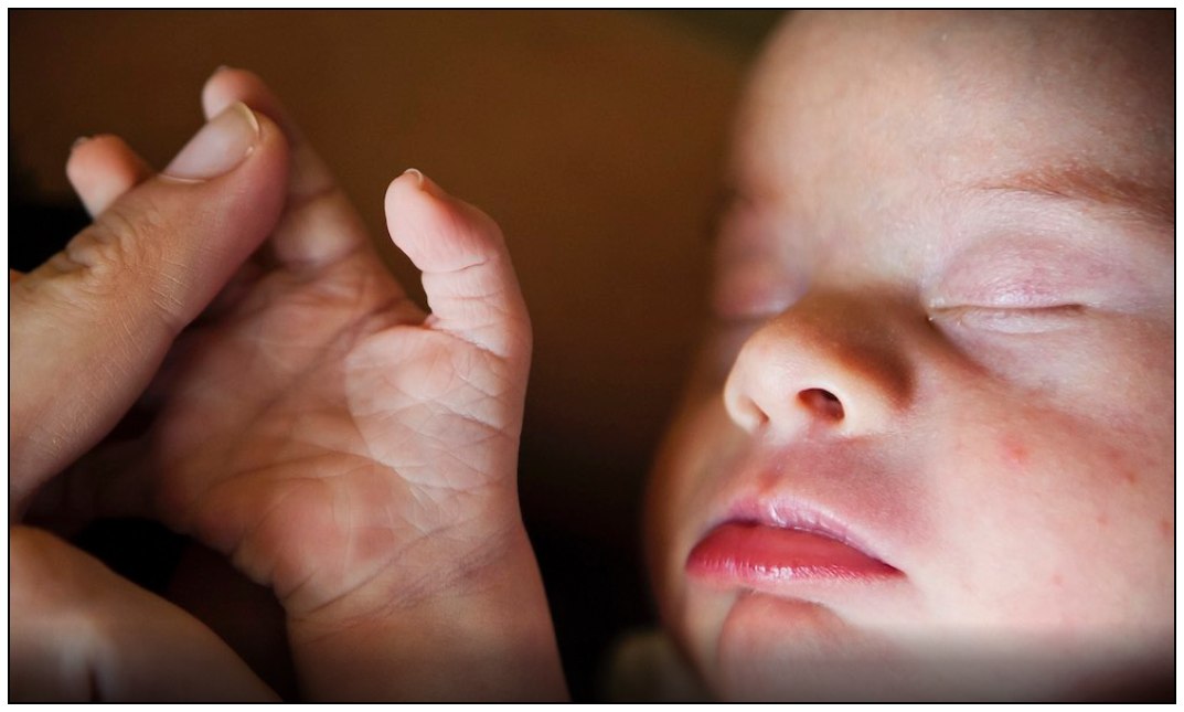baby born with Down Dyndrome